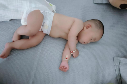 东莞六个月宝宝眼睛散光 东莞六个月宝宝眼睛散光